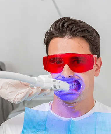 25303 laser teeth whitening adelaide session