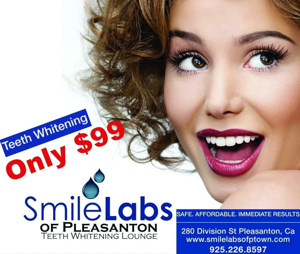 25304 in office teeth whitening