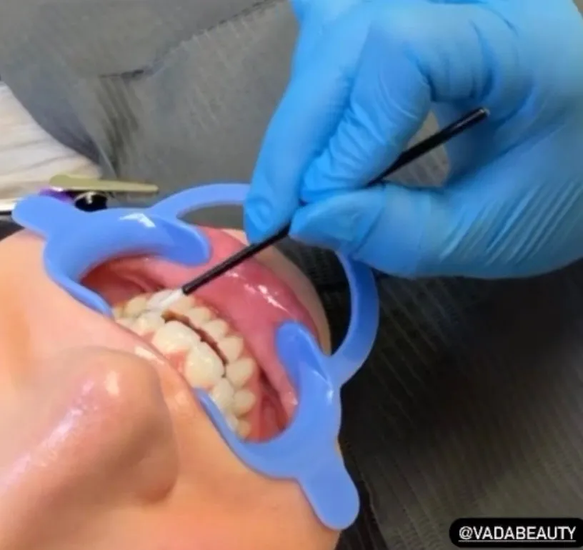 25307 dental insurance claims