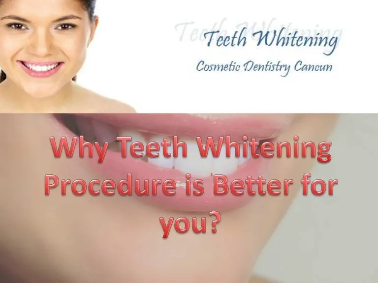 /img/25307-teeth-whitening-results.webp