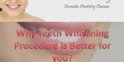 /img/25307-teeth-whitening-results.webp
