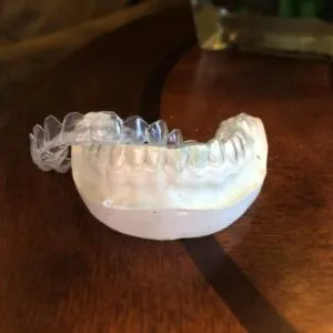 25310 professional teeth whitening