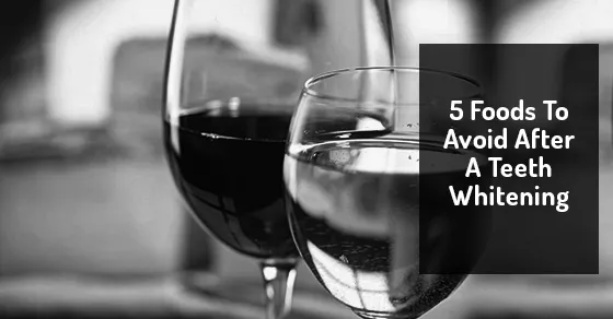 25312 teeth whitening options