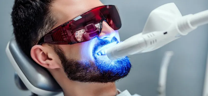 25315 da vinci teeth whitening consultation