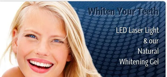 25315 da vinci teeth whitening process