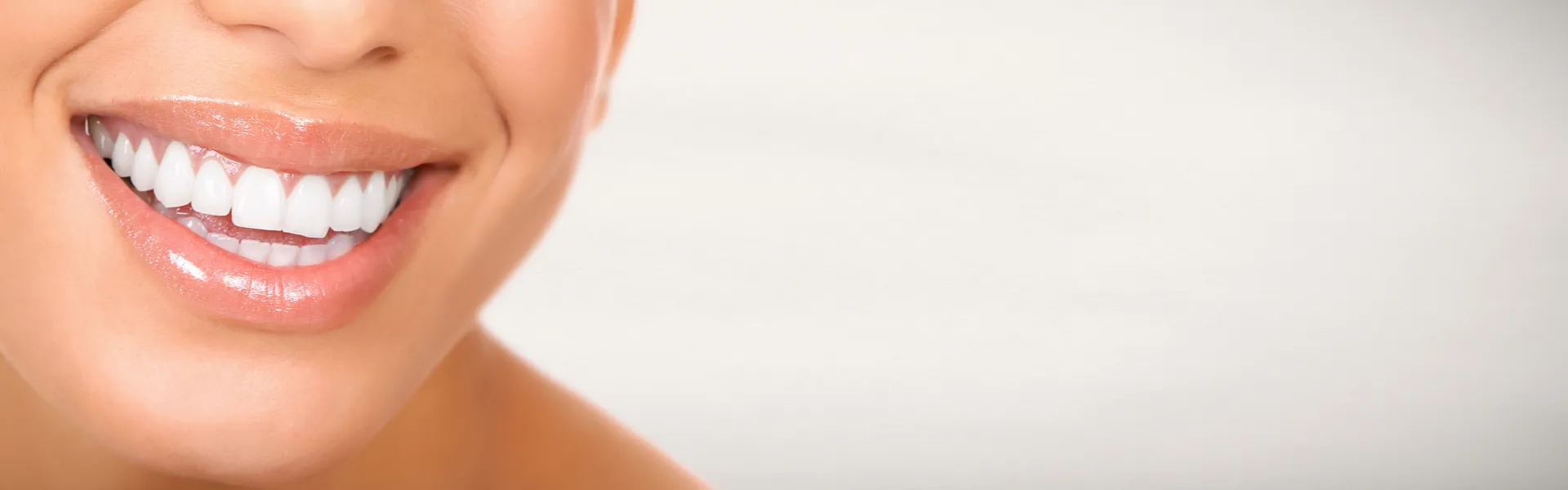 25325 teeth whitening results