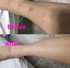 25326 healthy diet whitening legs