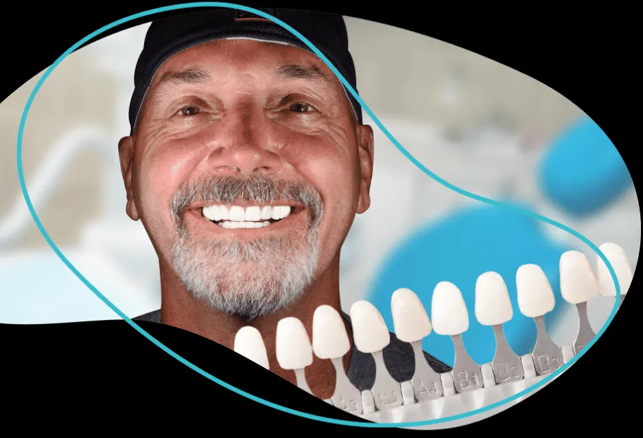 25332 cancun teeth whitening before after
