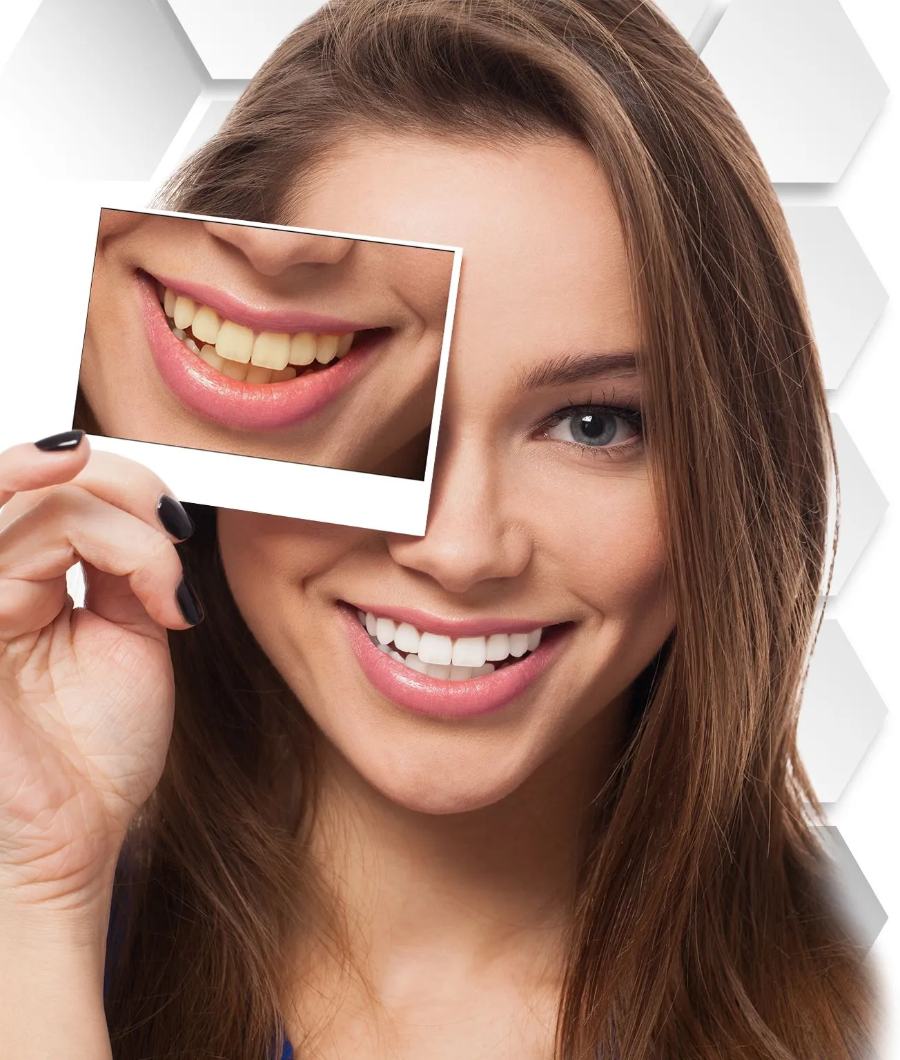 25332 cancun teeth whitening clinic