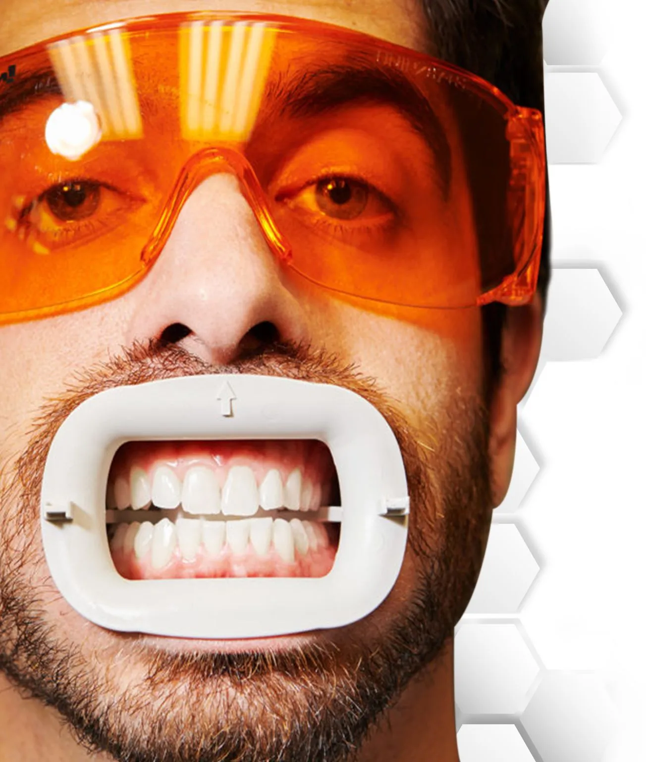 25332 cancun teeth whitening options