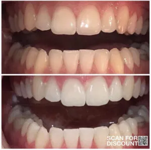 25334 ap24 fresh breath