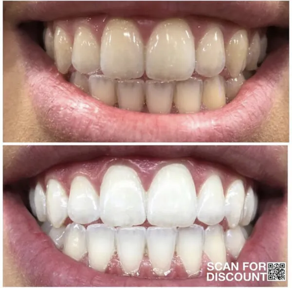 25334 ap24 user reviews