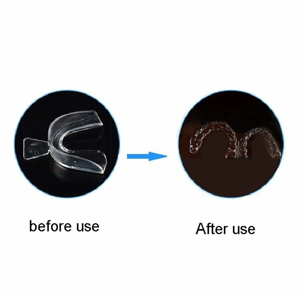 25352 professional teeth whitening