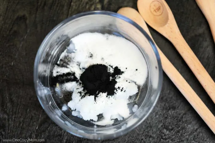 25358 teeth whitening before after