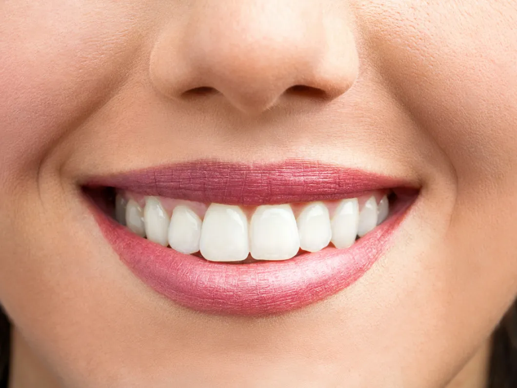 /img/25369-teeth-whitening-consultation.webp