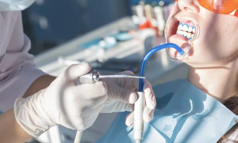 25369 teeth whitening sensitive teeth