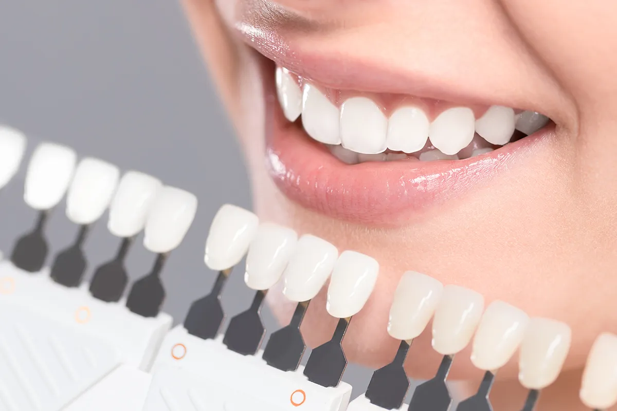 25372 teeth whitening options mexico
