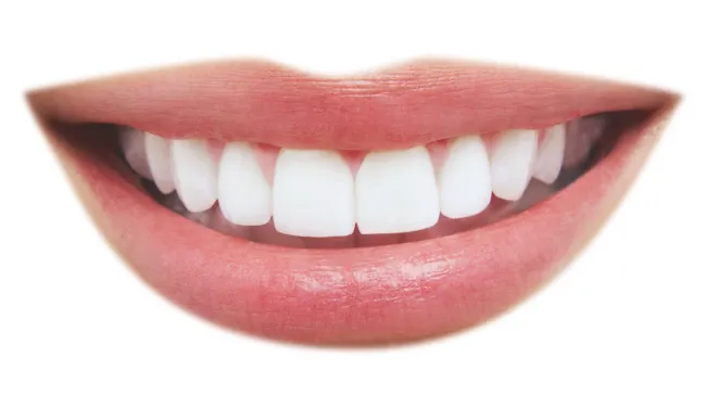 25373 teeth whitening redondo beach 3