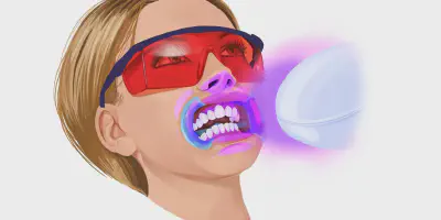 /img/25378-teeth-whitening-risks.webp