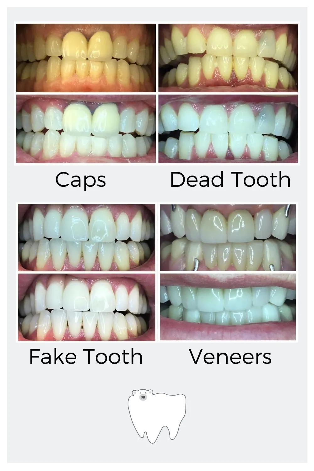 25381 led whitening safe use