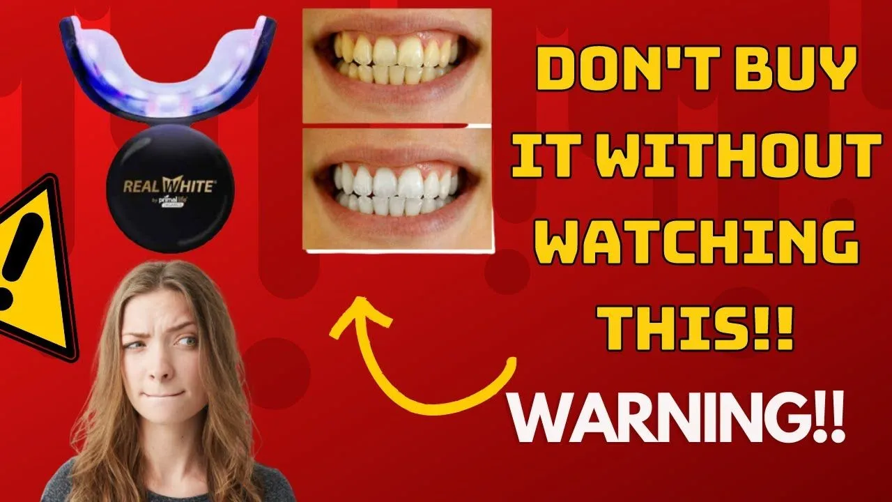 25381 led whitening systems