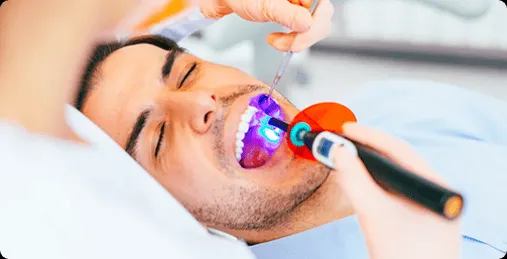 25390 affordable teeth whitening