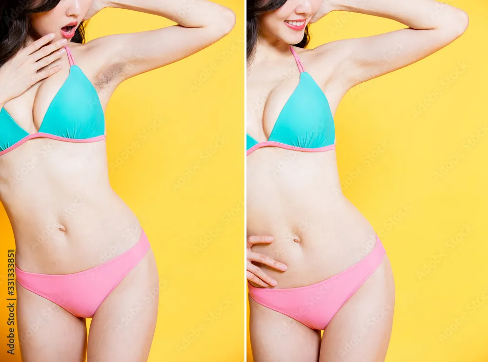 25402 armpit hair removal