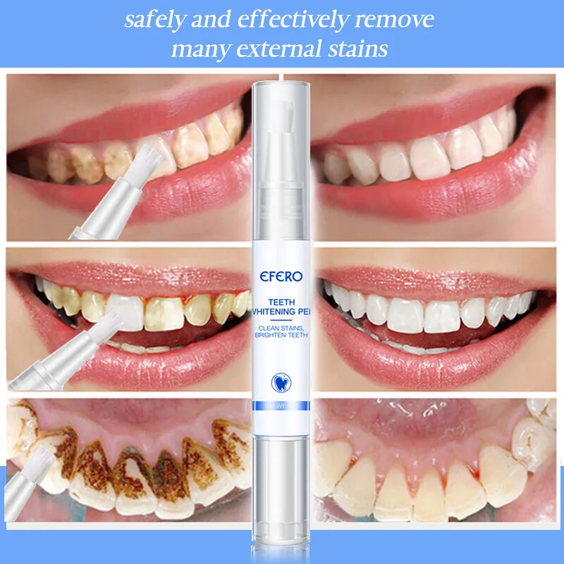 25406 dental veneers