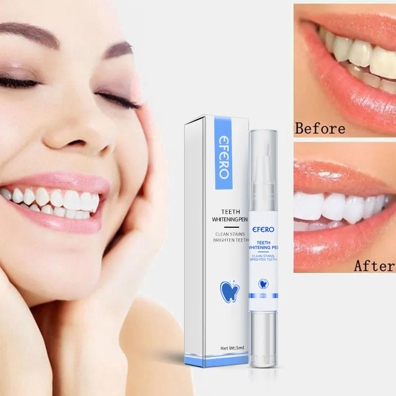 25406 professional teeth whitening