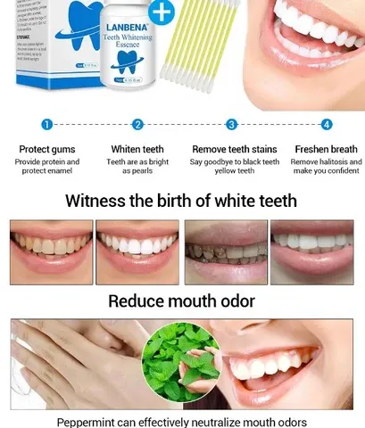 25406 teeth whitening procedure
