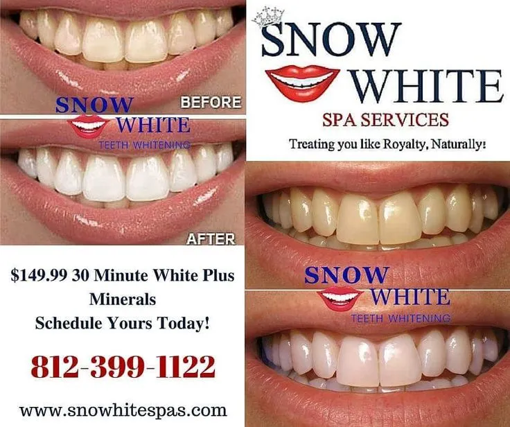 25416 teeth whitening products