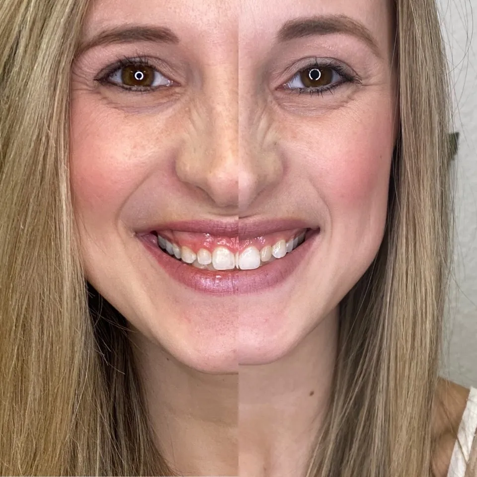 25427 smile secret teeth whitening confidence