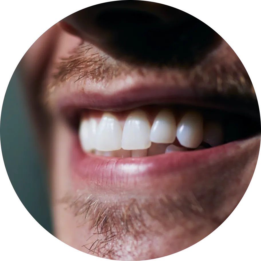 25456 teeth whitening valencia