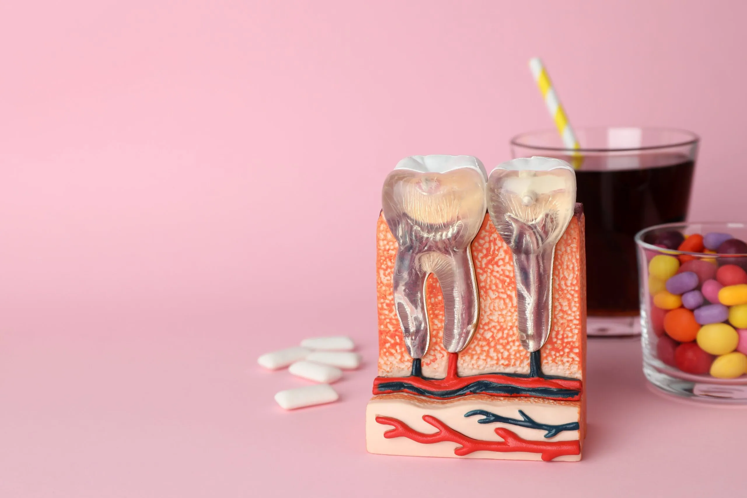 25458 enamel erosion