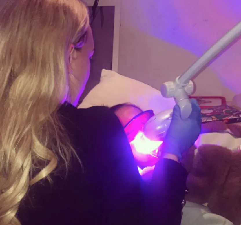 25467 custom teeth whitening trays