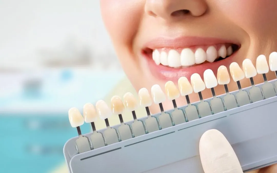 25473 teeth whitening adelaide