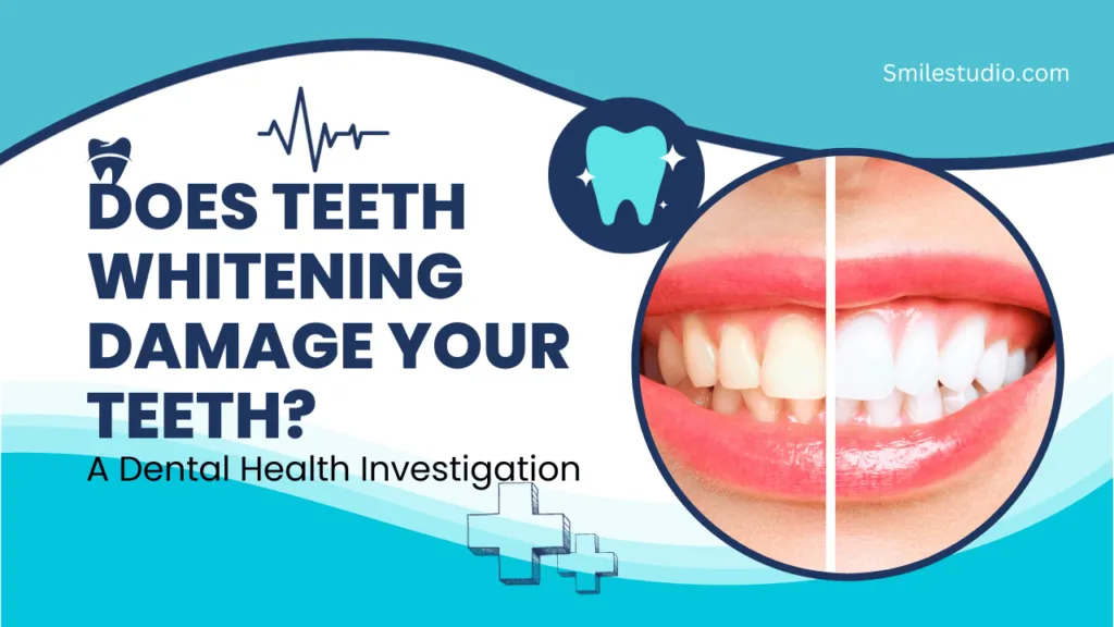 25477 teeth whitening alternatives