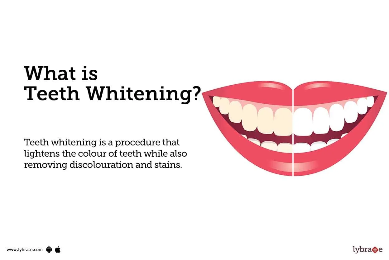25477 teeth whitening products