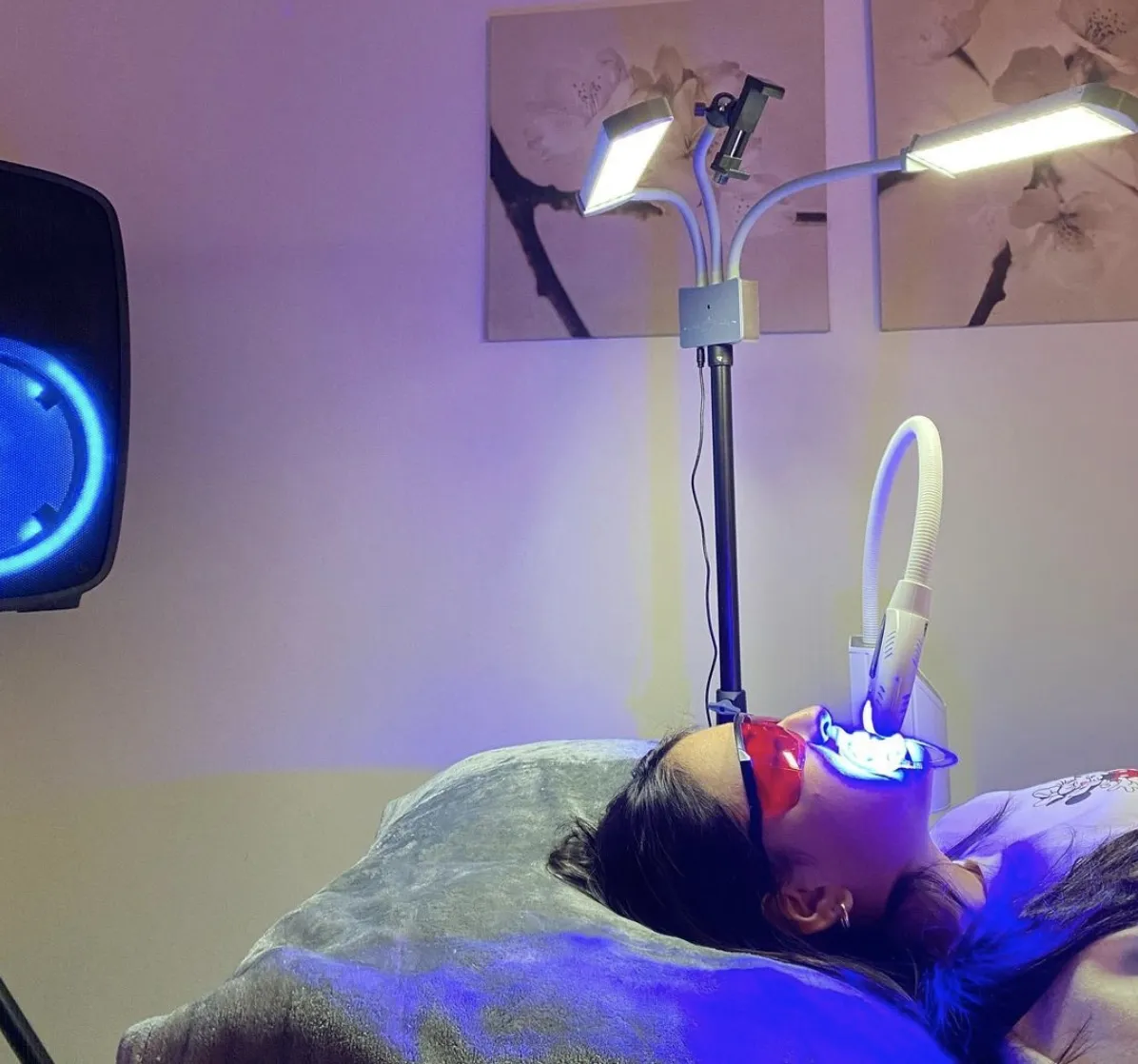 25485 teeth cleaning