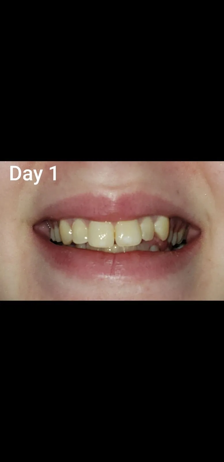 25497 charcoal powder