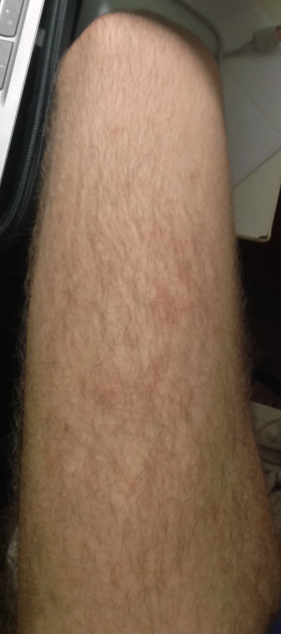 25507 skin whitening advice 3