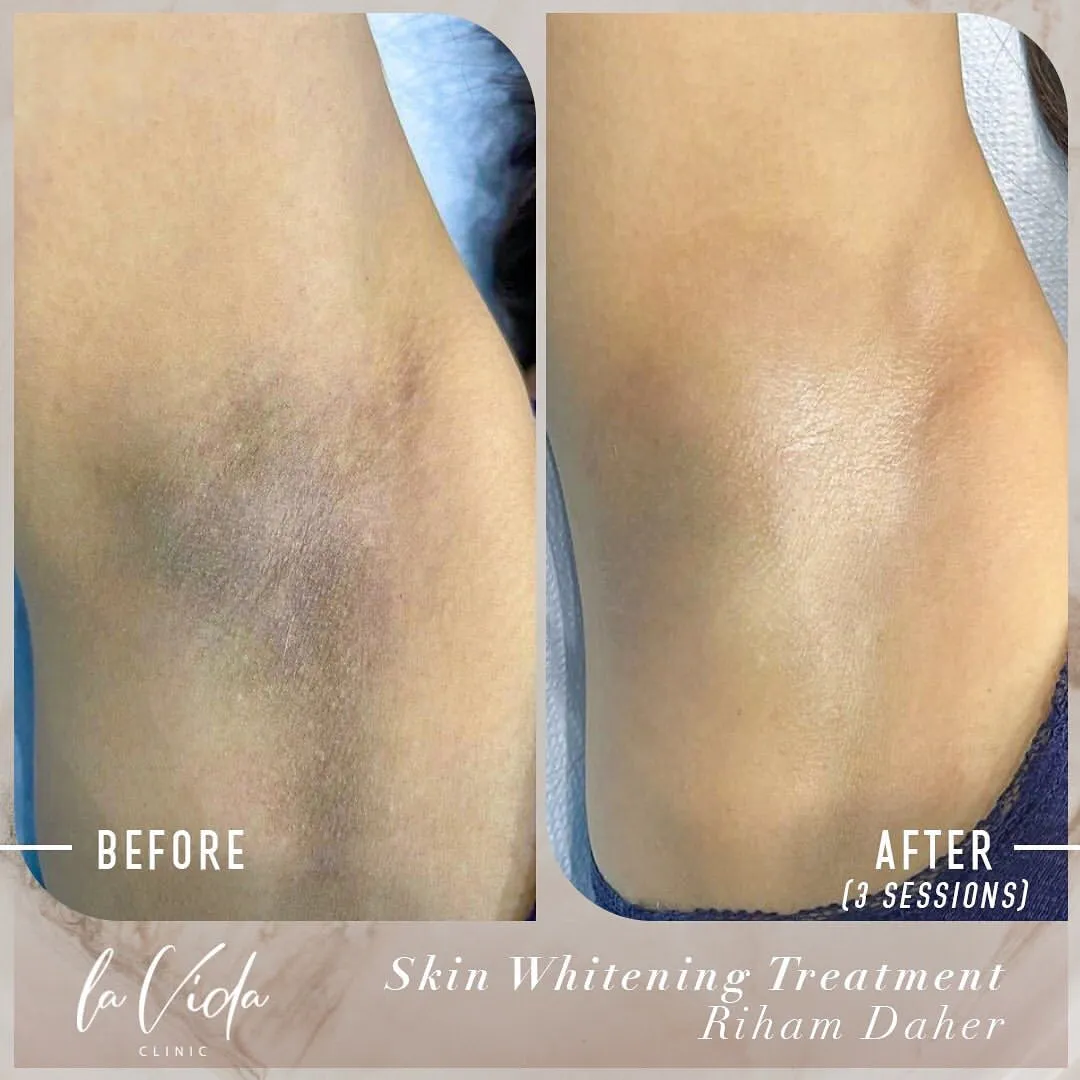 25507 skin whitening advice 5