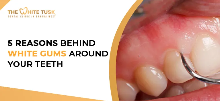 25510 brushing and flossing