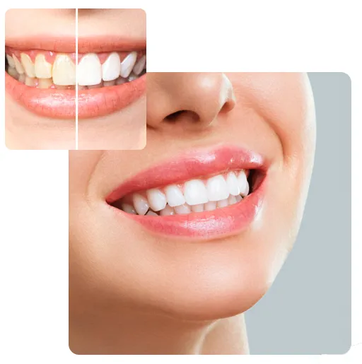 25515 sensitive teeth care