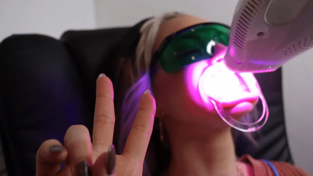 25526 zoom whitening results