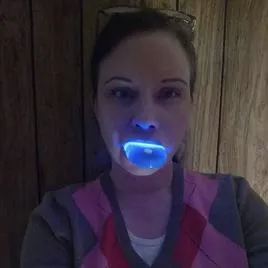 25534 whitening tray in mouth