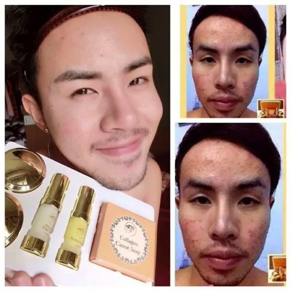 25535 whitening products thailand