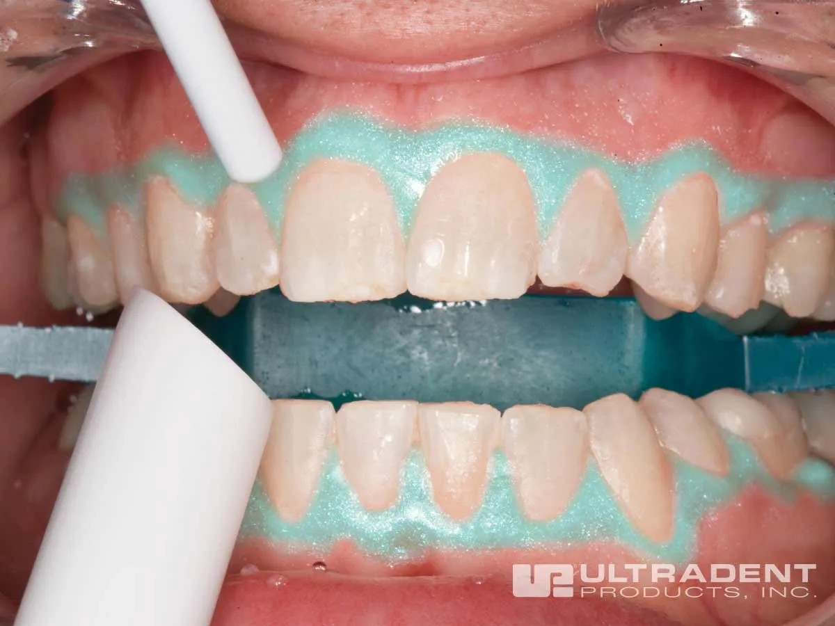 /img/25538-dentist-consultation.webp