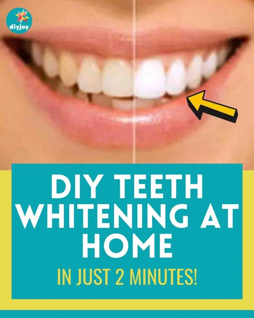 25551 teeth whitening ingredients