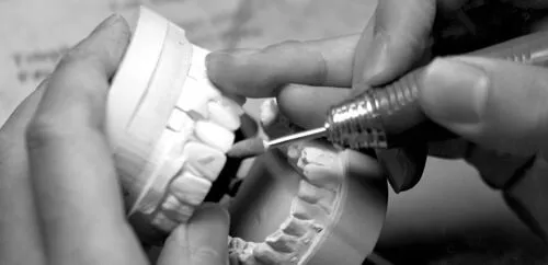 25553 teeth whitening boston deals image6